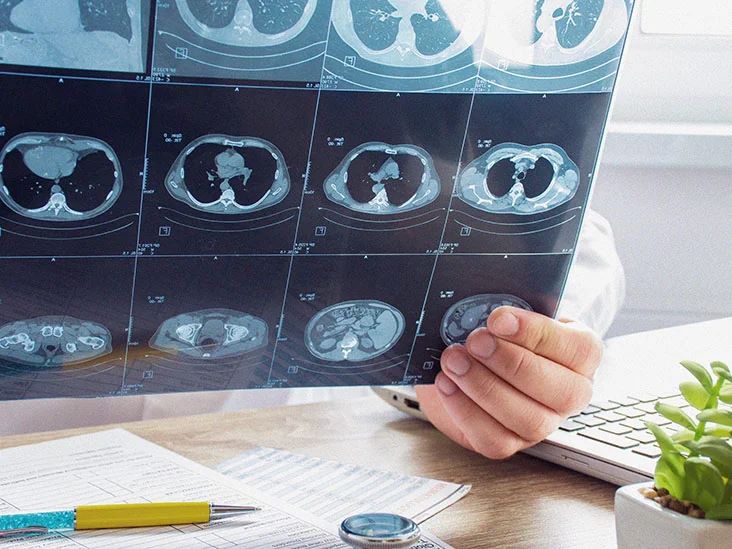 Lung Cysts Treatment in Bangalore 