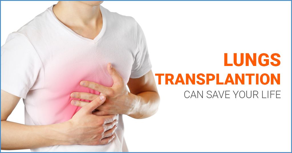 Lung Surgery Specialist Bangalore