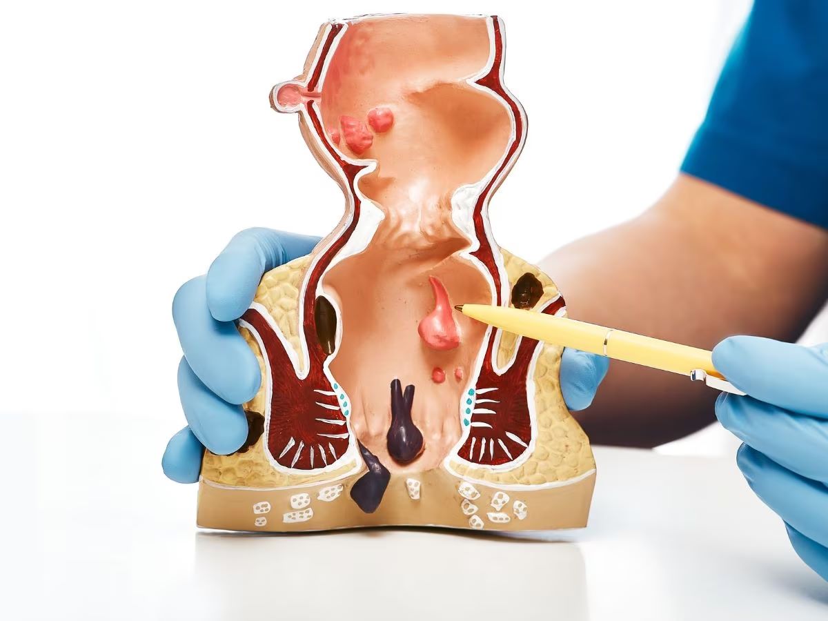 Tracheoesophageal Fistula Treatment in Bangalore