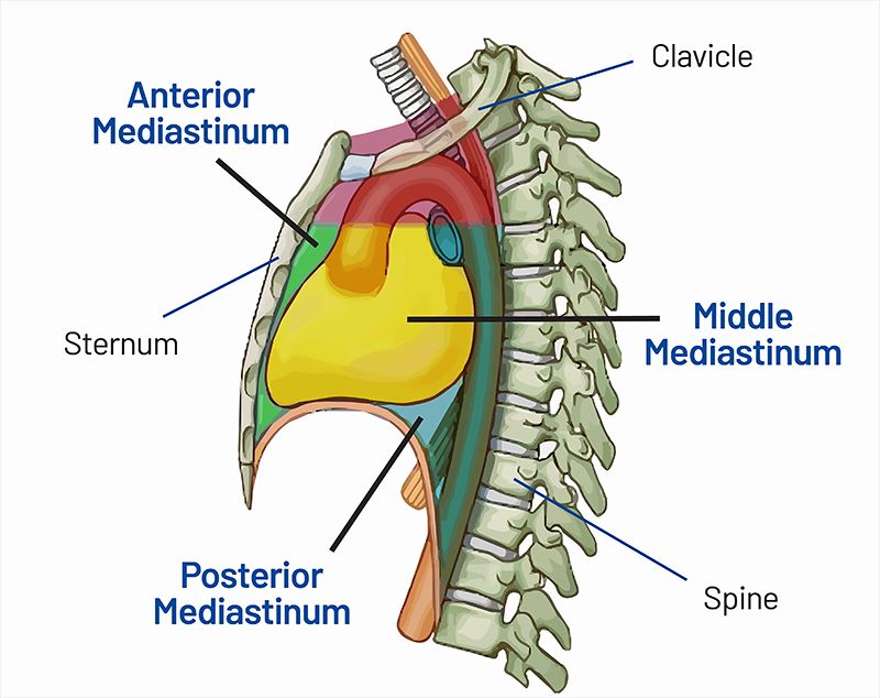 Posterior Mediastinal Tumour Treatment in Bangalore 
