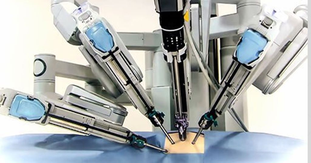 Robotic Assisted Thoracic Surgery Bangalore